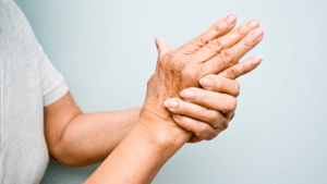 Treatment for Arthritis